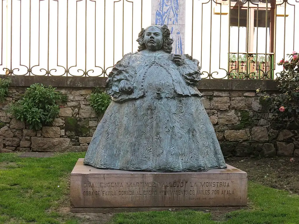 17. század, Eugénia Martínez Vallejo, Fizikai különbségek, II. Károly spanyol király, La Monstrua, Rendellenesség, ritka betegség, Spanyol királyi udvar, Történelmi anekdota, Udvari bolond