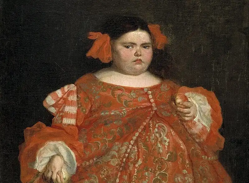 17. század, Eugénia Martínez Vallejo, Fizikai különbségek, II. Károly spanyol király, La Monstrua, Rendellenesség, ritka betegség, Spanyol királyi udvar, Történelmi anekdota, Udvari bolond