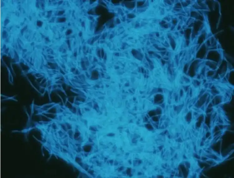 asztrobiológia, bioszféra, élet, extremofilek, felfedezés, földalatt, mélység, mikrobák, ökoszisztéma, tudomány