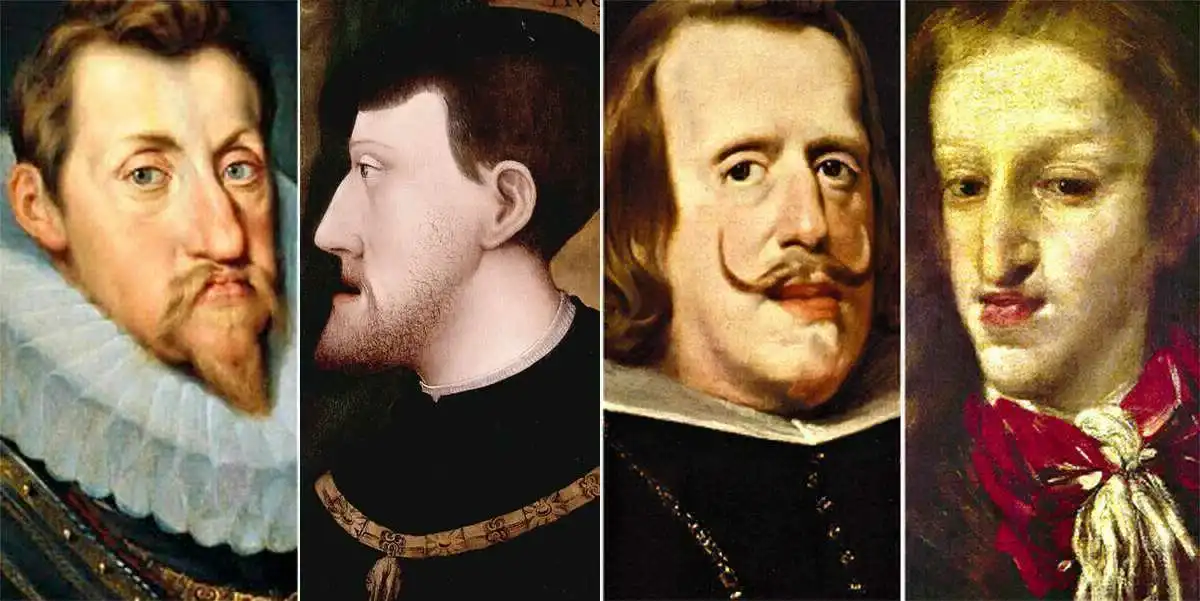 állkapocs-prognathizmus, családtörténet, egészségügyi problémák, Európa történelme, galéria, genetikai betegségek, Habsburg-dinasztia, Habsburgok, királyi családok, Spanyol történelem, vérfertőzés