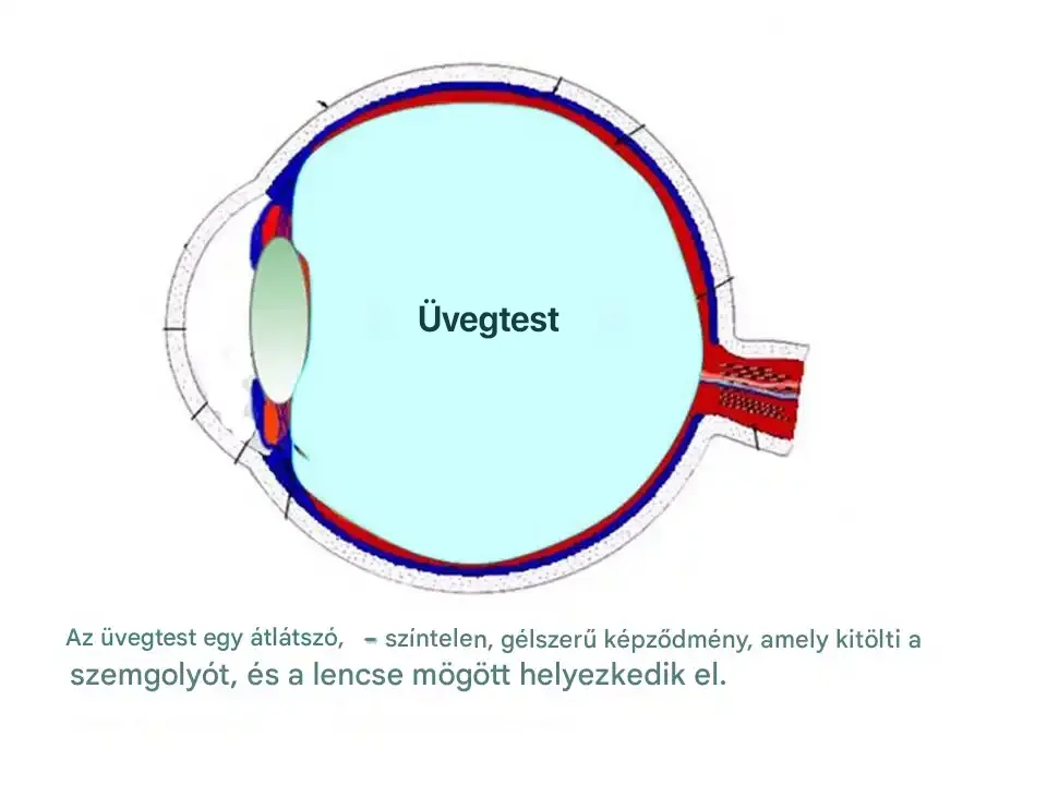 egészség, kollagén, látás, látászavarok, lebegő foltok, muscae volitantes, optikai jelenség, retina, szem, szembetegségek, üvegtest, vörösvértestek