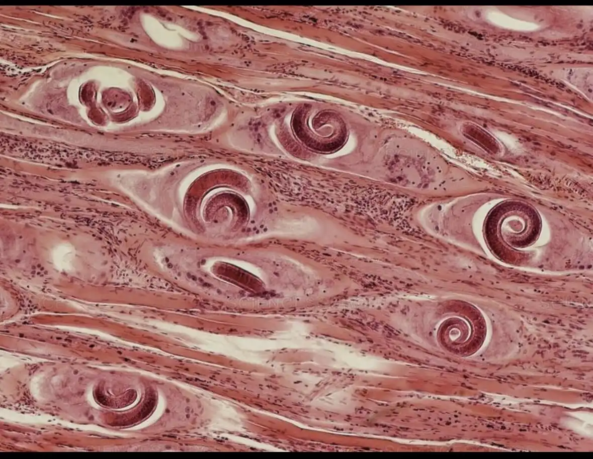 biológia, egészség, fertőzés, medve, parazita, természet, túlélés, vadászat, vadhús, veszély