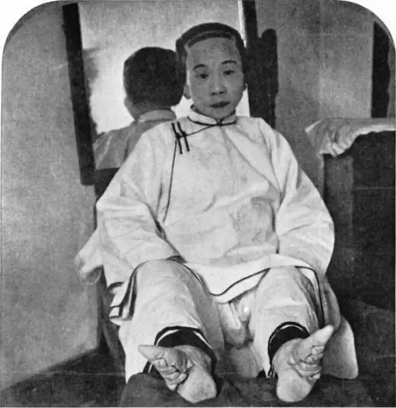 2004-es cunami, atombomba, Auschwitz, bányászok, Csernobil, cunami, elmegyógyintézet, furcsa fotók, Gyatlov-hágó rejtélye, Gyatlov-incidens, hátborzongató fotók, Hirosima, holokauszt, kínai lábkötés, lobotomia, lótuszláb, megdöbbentő fotók, nukleáris katasztrófa, pókanya, pókok, pszichiátria, rabszolga-felszabadítás, rabszolgaság, skizofrénia, sokkoló képek, szeptember 11, terrortámadás, történelmi fotók