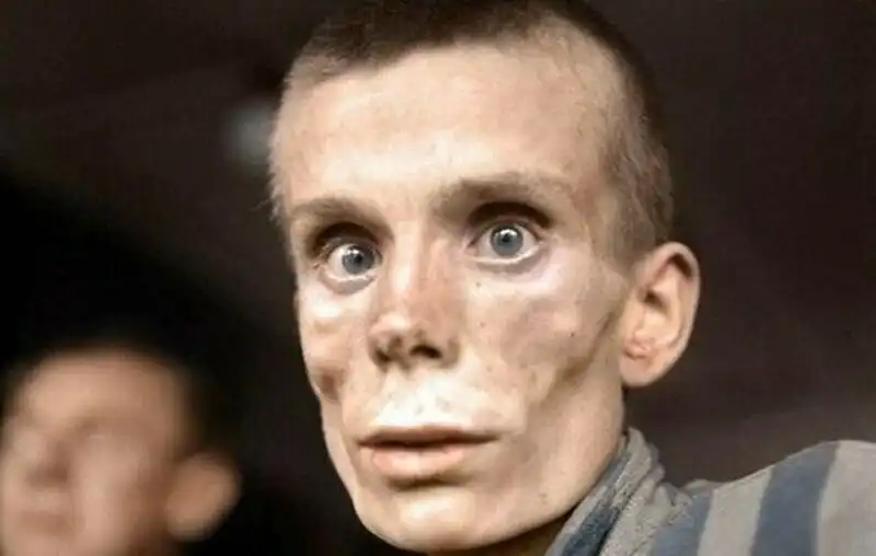 2004-es cunami, atombomba, Auschwitz, bányászok, Csernobil, cunami, elmegyógyintézet, furcsa fotók, Gyatlov-hágó rejtélye, Gyatlov-incidens, hátborzongató fotók, Hirosima, holokauszt, kínai lábkötés, lobotomia, lótuszláb, megdöbbentő fotók, nukleáris katasztrófa, pókanya, pókok, pszichiátria, rabszolga-felszabadítás, rabszolgaság, skizofrénia, sokkoló képek, szeptember 11, terrortámadás, történelmi fotók