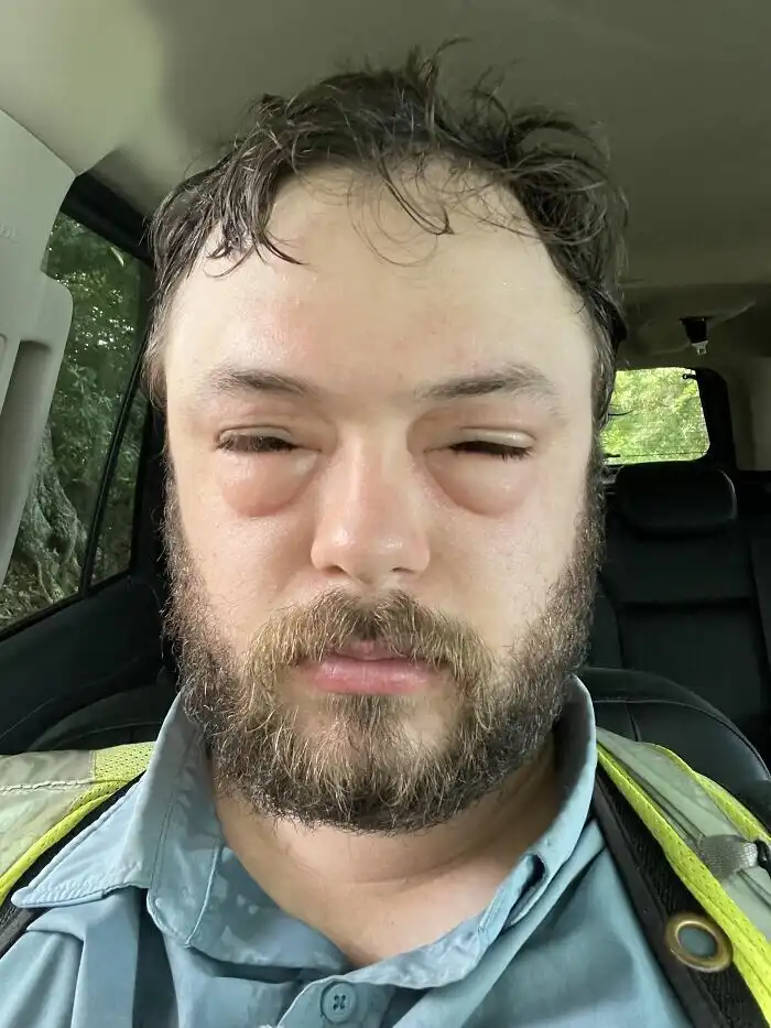 bakik, balszerencse, humor, irónia, képek, kudarc, mindennapi élet, szerencsétlenség, váratlan, vicces