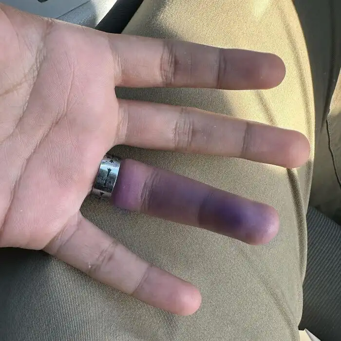 bakik, balszerencse, humor, irónia, képek, kudarc, mindennapi élet, szerencsétlenség, váratlan, vicces