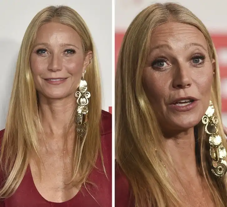 arckezelés, bőrápolás, Jennifer Lopez, Nicole Kidman, öregedésgátlás, plasztikai sebészet, smink nélkül, szépségápolás