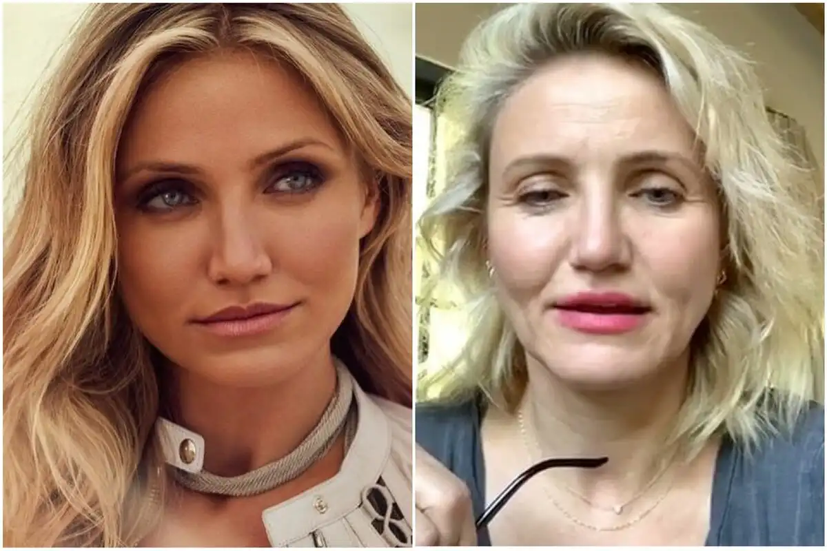 arckezelés, bőrápolás, Jennifer Lopez, Nicole Kidman, öregedésgátlás, plasztikai sebészet, smink nélkül, szépségápolás