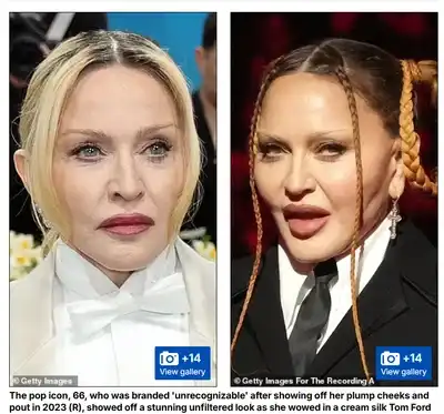 arckezelés, bőrápolás, Jennifer Lopez, Nicole Kidman, öregedésgátlás, plasztikai sebészet, smink nélkül, szépségápolás