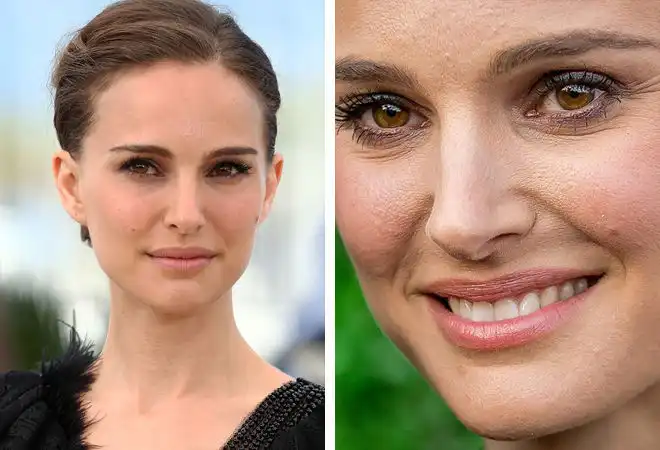 arckezelés, bőrápolás, Jennifer Lopez, Nicole Kidman, öregedésgátlás, plasztikai sebészet, smink nélkül, szépségápolás