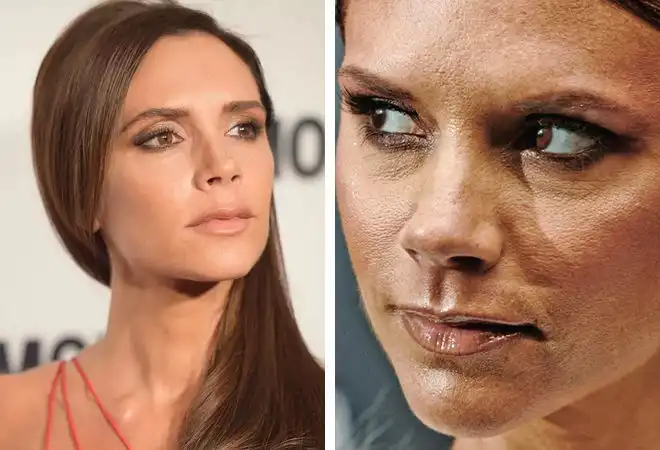 arckezelés, bőrápolás, Jennifer Lopez, Nicole Kidman, öregedésgátlás, plasztikai sebészet, smink nélkül, szépségápolás