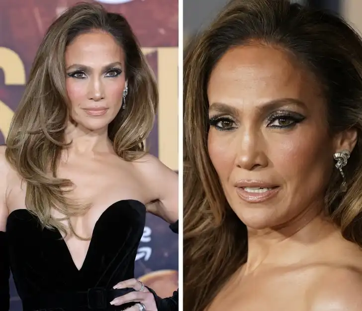 arckezelés, bőrápolás, Jennifer Lopez, Nicole Kidman, öregedésgátlás, plasztikai sebészet, smink nélkül, szépségápolás