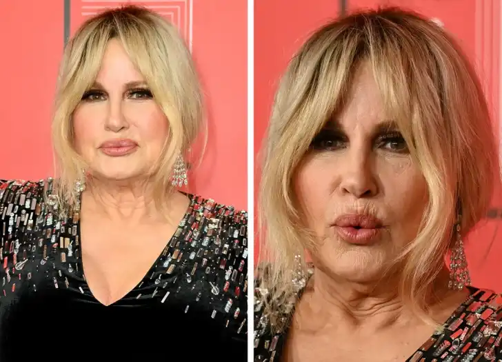 arckezelés, bőrápolás, Jennifer Lopez, Nicole Kidman, öregedésgátlás, plasztikai sebészet, smink nélkül, szépségápolás