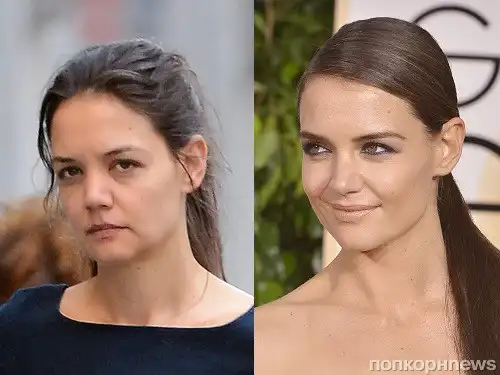 arckezelés, bőrápolás, Jennifer Lopez, Nicole Kidman, öregedésgátlás, plasztikai sebészet, smink nélkül, szépségápolás