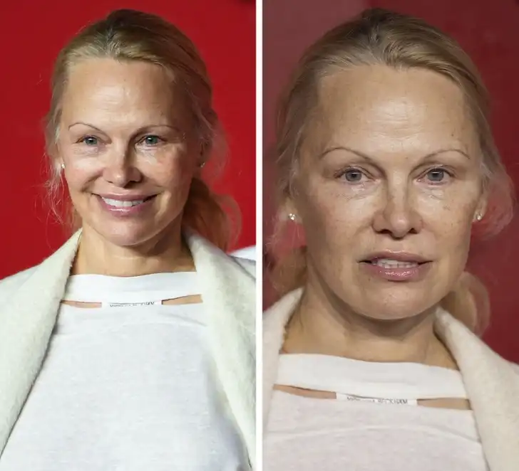 arckezelés, bőrápolás, Jennifer Lopez, Nicole Kidman, öregedésgátlás, plasztikai sebészet, smink nélkül, szépségápolás