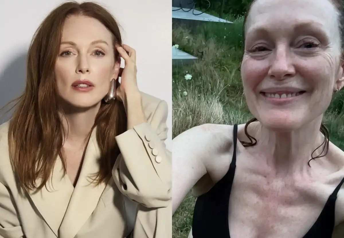 arckezelés, bőrápolás, Jennifer Lopez, Nicole Kidman, öregedésgátlás, plasztikai sebészet, smink nélkül, szépségápolás