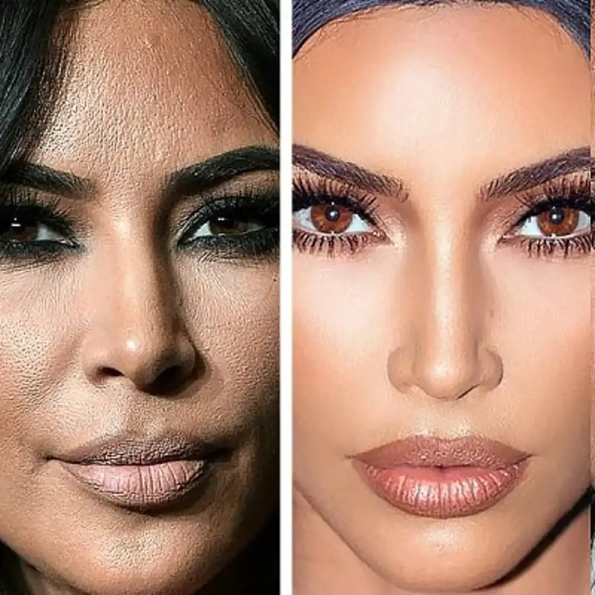 arckezelés, bőrápolás, Jennifer Lopez, Nicole Kidman, öregedésgátlás, plasztikai sebészet, smink nélkül, szépségápolás
