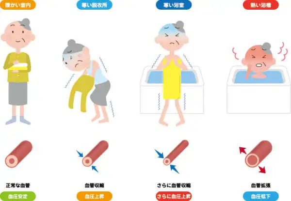 balesetmegelőzés, egészségmegőrzés, forró fürdő, hősokk, japán, magas vérnyomás, onszen, szívinfarktus tünetei