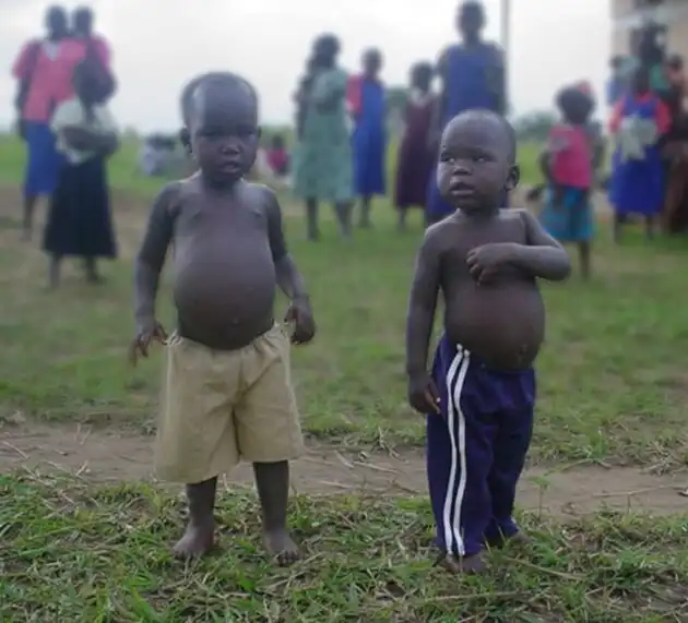 afrika, betegség, egészség, éhezés, gyerekek, klímaváltozás, szegénység, táplálkozás, társadalom, Válság