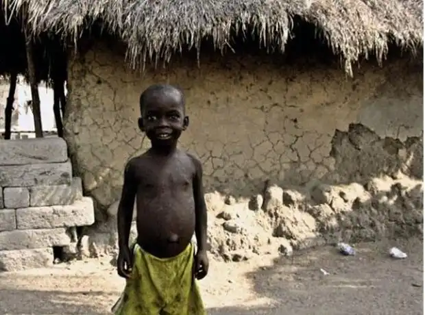 afrika, betegség, egészség, éhezés, gyerekek, klímaváltozás, szegénység, táplálkozás, társadalom, Válság